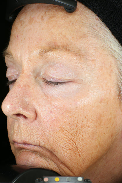 Wrinkle + Texture Repair