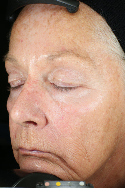 Wrinkle + Texture Repair